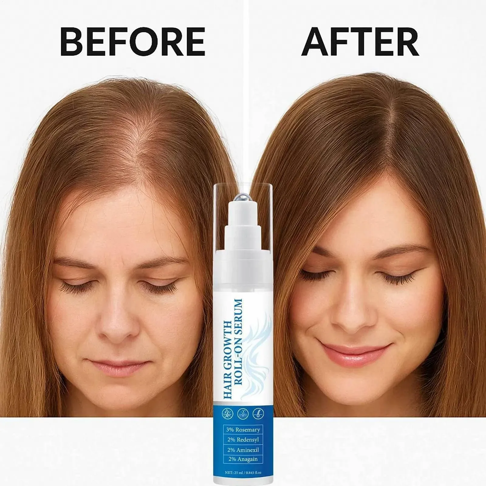 Засіб для росту волосся demaxiyad Розчин для відновлення шкіри голови 25 мл, фото №4