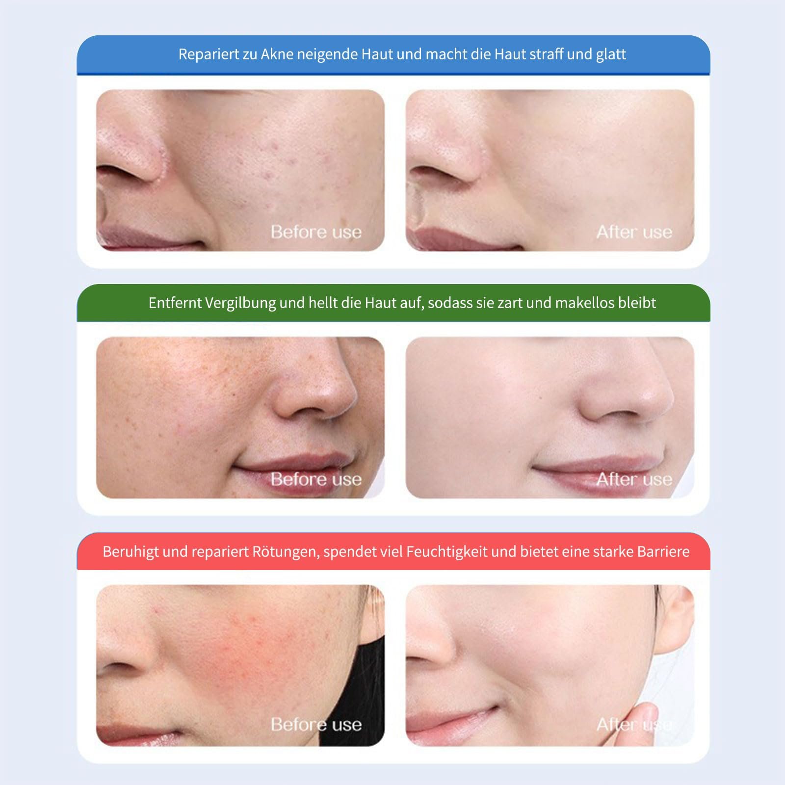 Тканинні маски для обличчя Набір Зволоження Зміцнення, фото №6