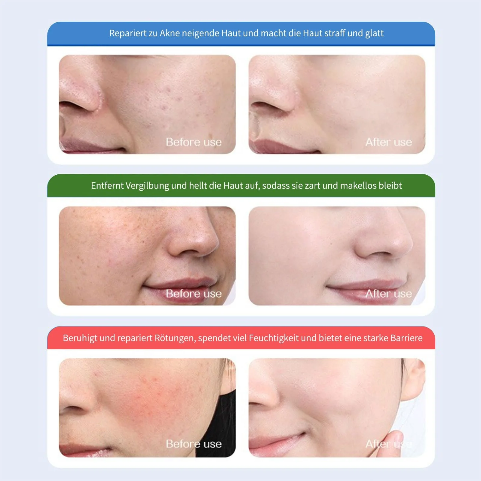 Тканевые маски для лица Набор Увлажнение Маска для лица Укрепляющая Маска для лица для успокоения кожи Маски для лица для сухой кожи, фото №6