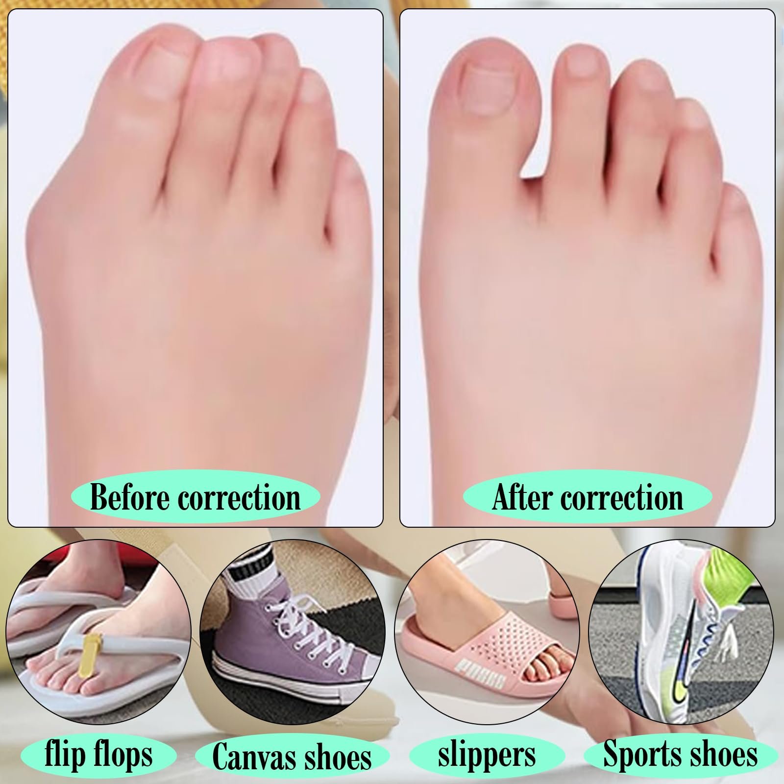 Комплект із 2 бандажів Hallux Valgus, ультратонка тканина для корекції Hallux Valgus, фото №6