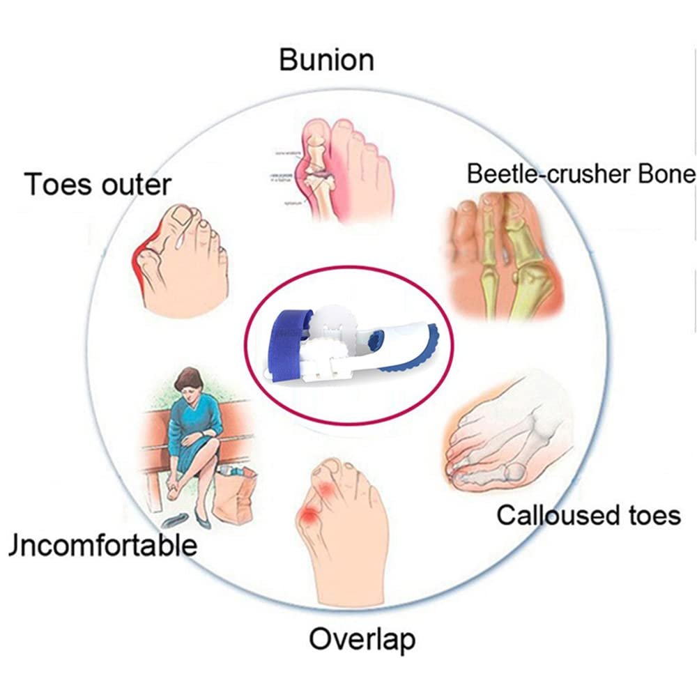 Роздільник для пальців ніг (2 шт.) Hallux Valgus Corrector Коректор кісточки на великому пальці ноги, фото №5