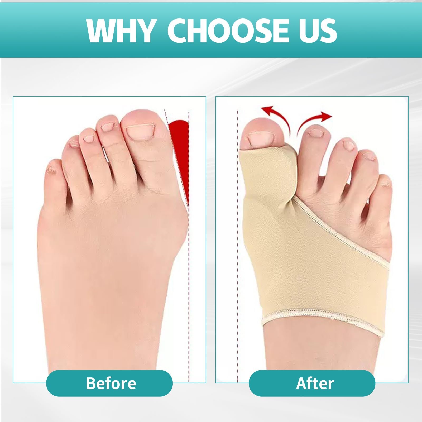 Шкарпетки Hallux Valgus 2 пари, бандаж для корекції Hallux Valgus, фото №4