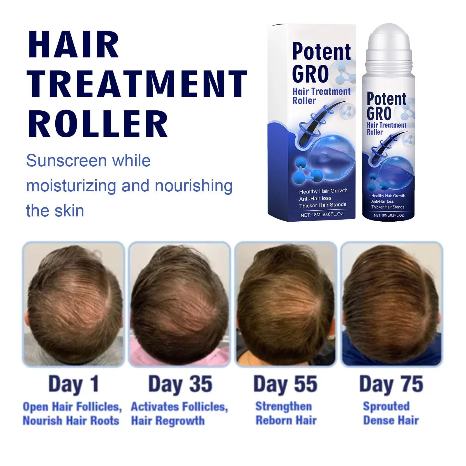 Розчин для росту волосся Pemarlis, Роликова кулька для лікування волосяних фолікулів, фото №4