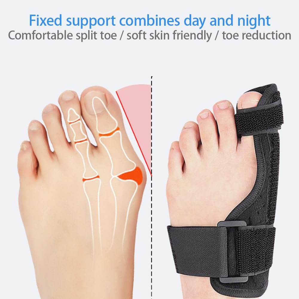 Роздільник для пальців ніг для корекції Hallux Valgus 1 пара Регульована пов'язка на шину для захисту, фото №4