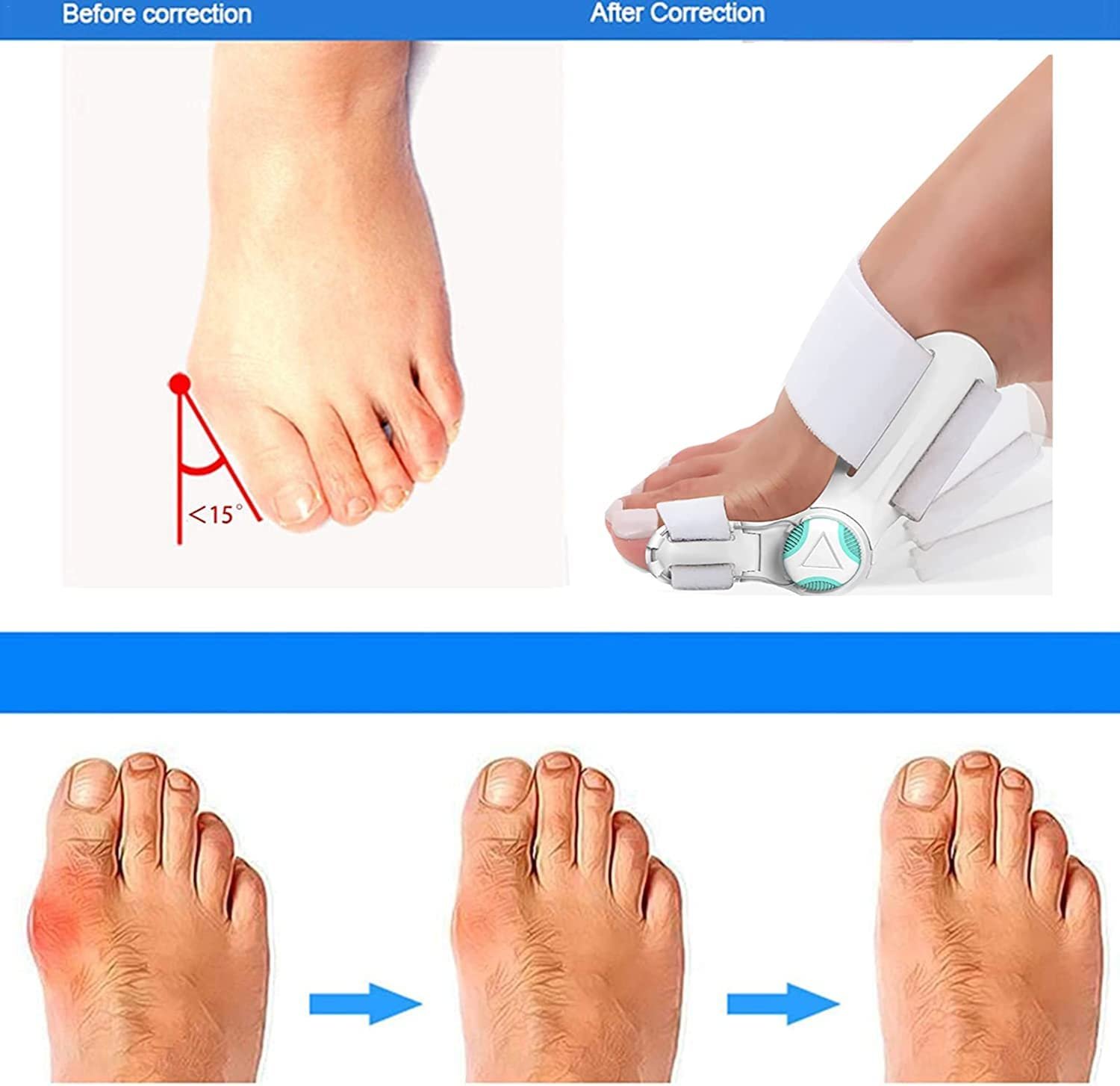 Корректор Бурси для Женщин и Мужчин Ортопедический Выпрямитель, фото №4