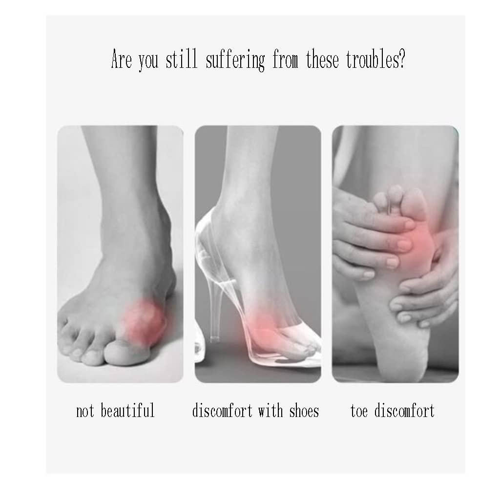 Коректор великого пальця стопи CAZARU для перекриваючих пальців, фото №5 Коректор великого пальця стопи CAZARU для перекриваючих пальців, фото №5