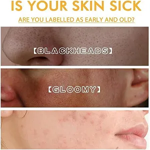 Маска для лица Juelreou От угрей, против старения, против морщин, от веснушек, для удаления пятен и черных точек, маска для сна Beautykomi, корейская коллагеновая маска-пленка для лица, уход за кожей (2 synthetic.ua - Фото 1