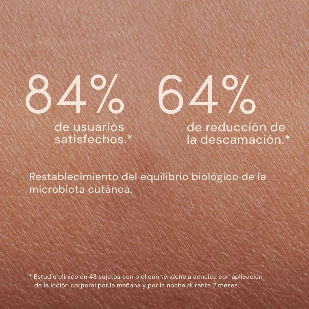 Лосьйон-спрей Vincobiose Dermobalancing Acneic для тіла, фото №7