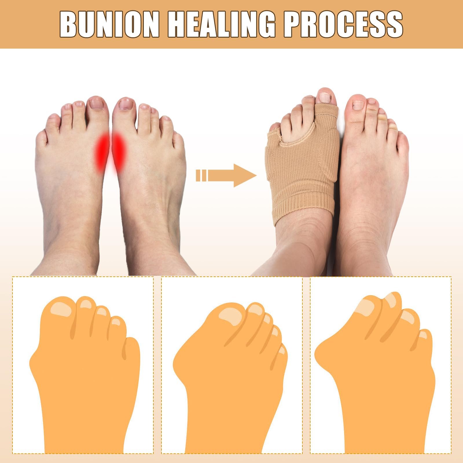 Подушечки для захисту великого пальця стопи Покращені, фото №4