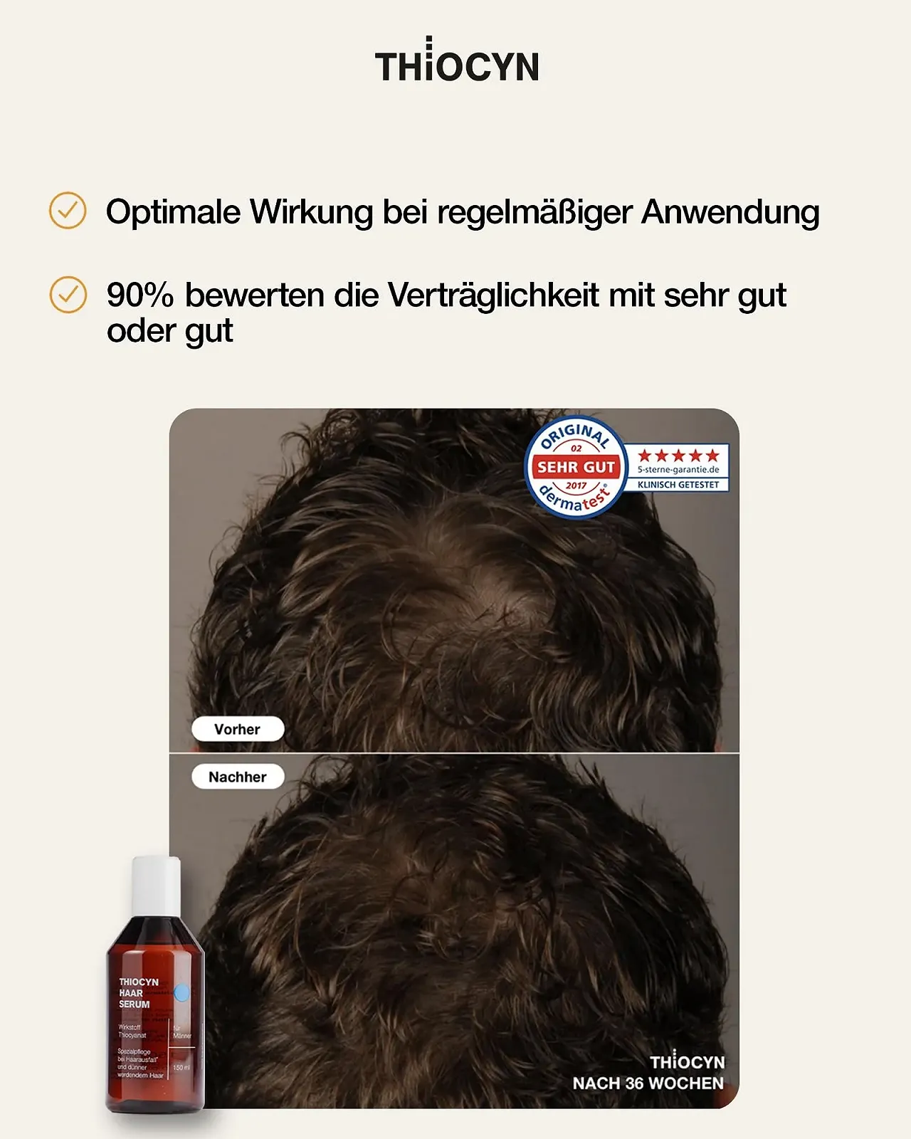 Сироватка Thiocyn проти випадіння волосся для чоловіків, що прискорює ріст волосся (3 x 150 мл), фото №5