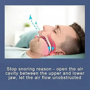 Засіб від хропіння Капа для рота для захисту зубів від скреготіння, нічна synthetic.ua - Фото 1