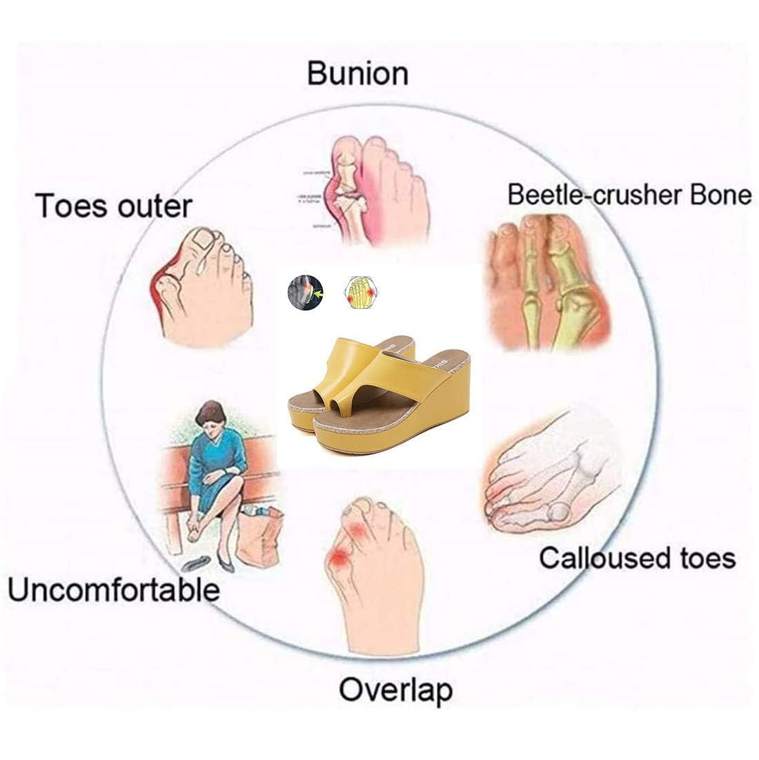 Ортопедические Шлепанцы Женские Открытый носок, фото №2