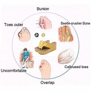 Ортопедические Шлепанцы Женские Открытый носок synthetic.ua - Фото 1