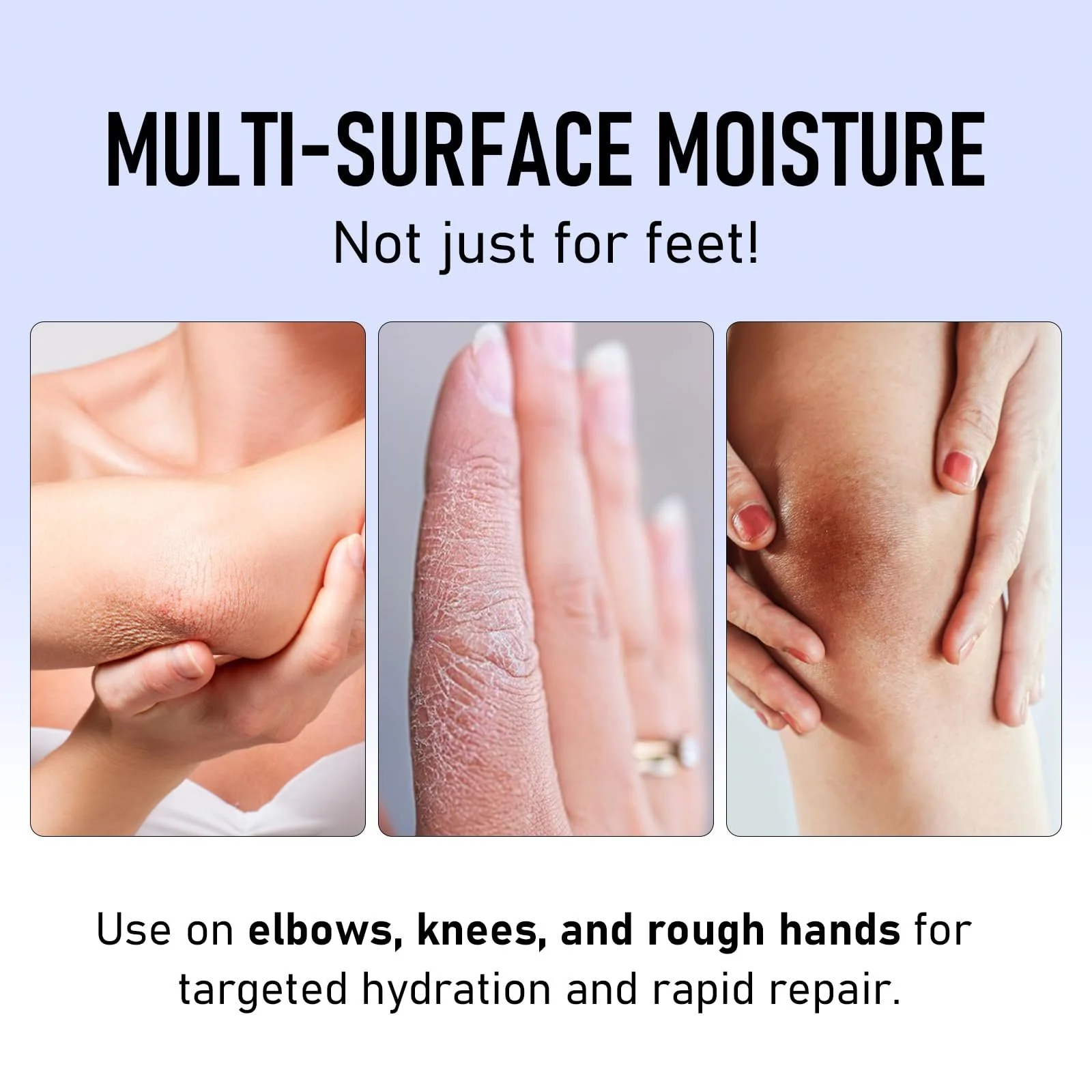 Крем для ног KYDA увлажняющий против трещин 2 шт 4.5 oz, фото №5 Крем для ног KYDA увлажняющий против трещин 2 шт 4.5 oz, фото №5