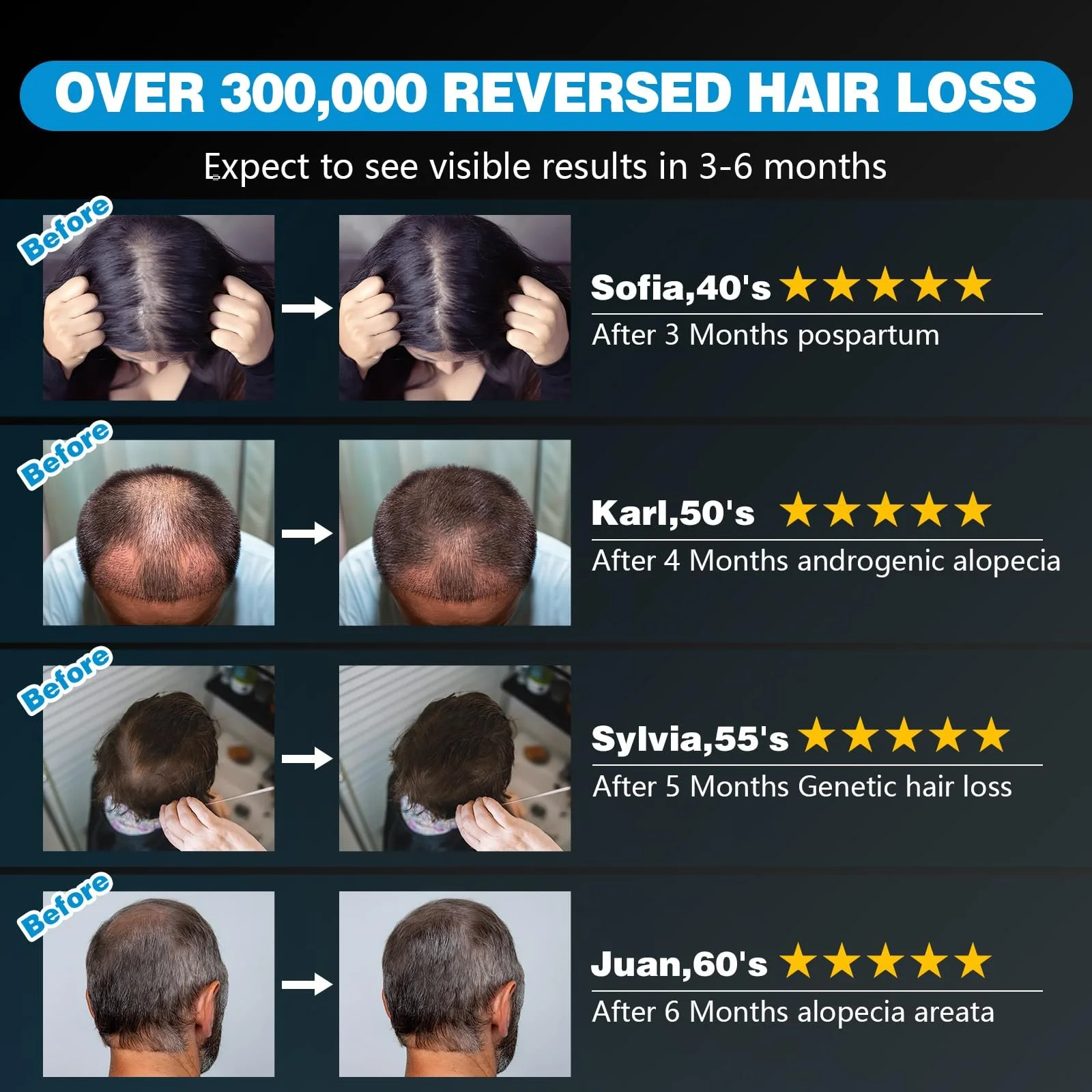 Лазерна Кепка iKeener lllt для росту волосся та проти випадіння волосся, 660 нм та 850 нм, фото №6