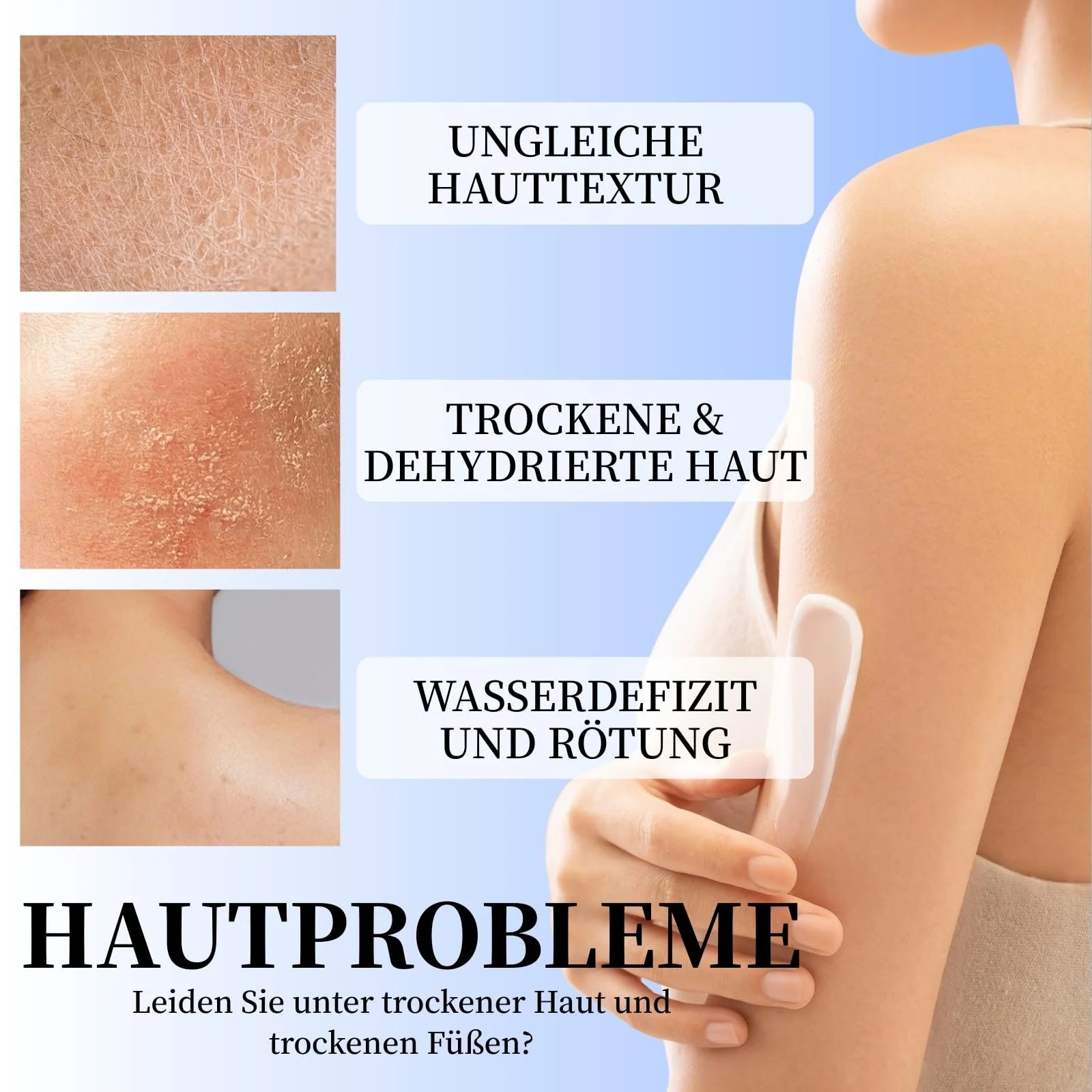 Крем для ног и лосьон для тела Urea Cream 60% Urea с маслом жожоба и алое вера, фото №5