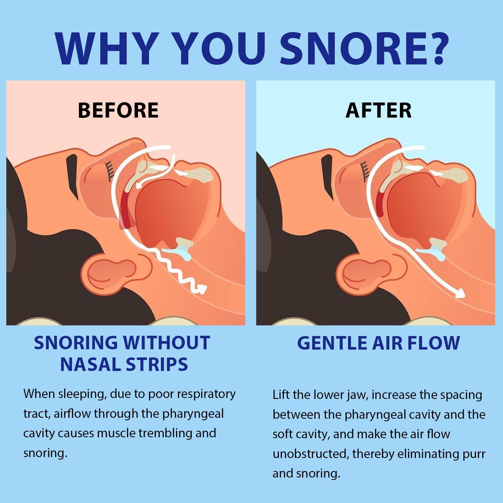 Шина проти хропіння, фото №5 Шина проти хропіння, фото №5