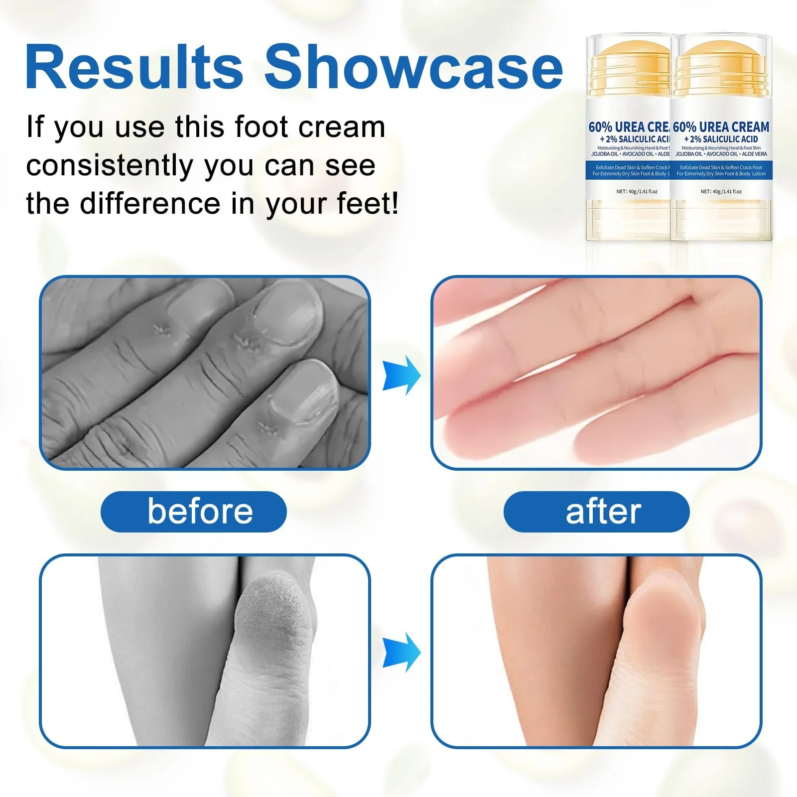 Крем для ног увлажняющий с мочевиной 60% и салициловой кислотой 2% против трещин (упаковка из 2 шт.), фото №5