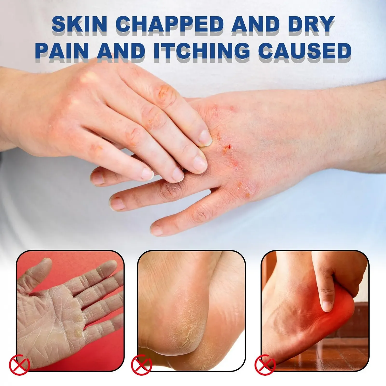 Крем для ног Urea 42% мочевины 42% Urea Cream, фото №7