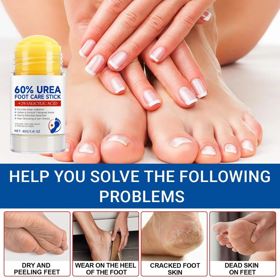 Крем для ног Urea Cream 60%, 2 шт., фото №5 Крем для ног Urea Cream 60%, 2 шт., фото №5