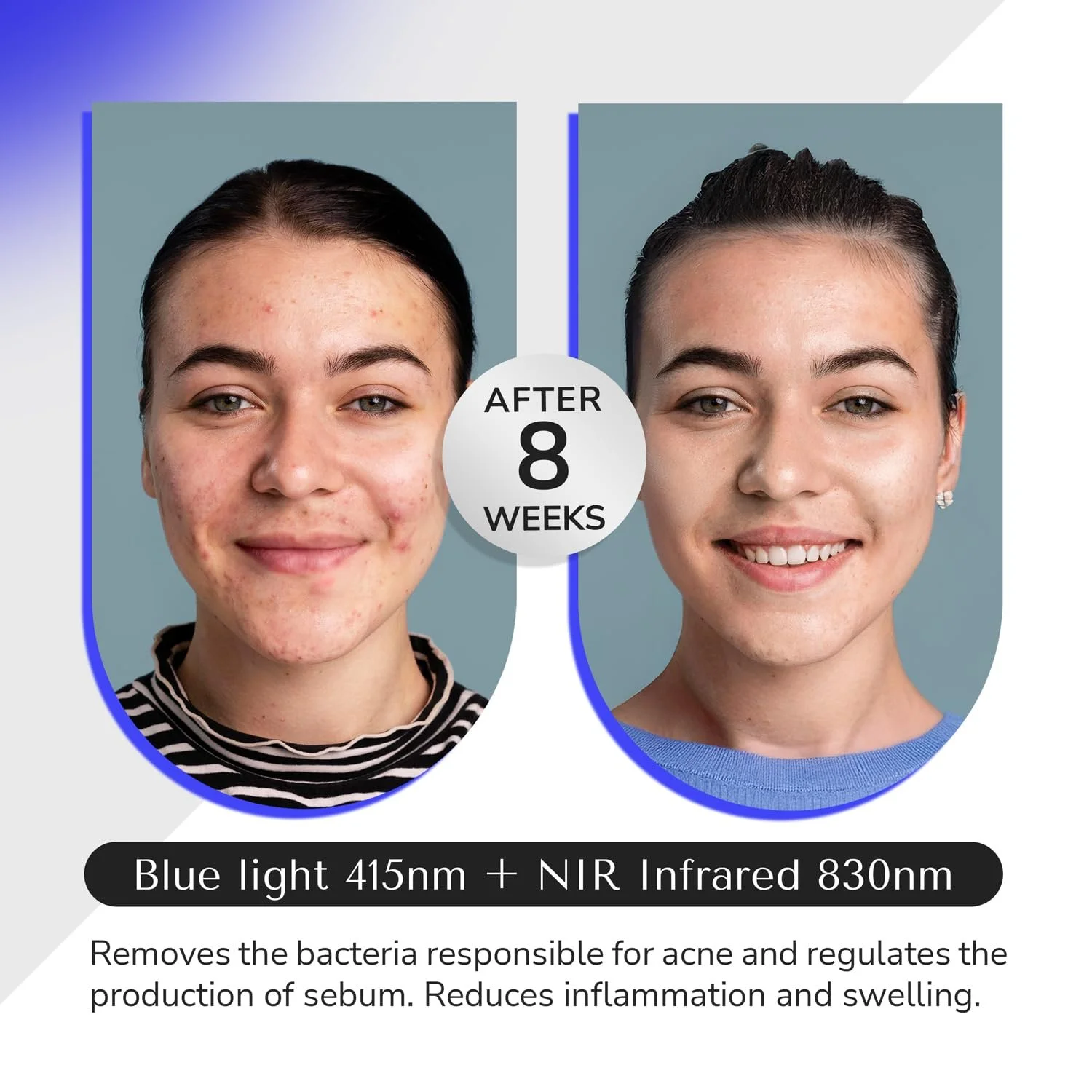 LED Маска для обличчя ODELYNE AdaraPRO з інфрачервоним та червоним світлом 830 нм, 4 довжини хвиль (415-830 нм), 432 світлодіоди, фото №3