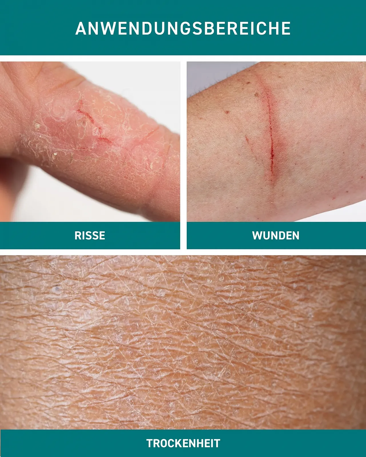 Крем для рук N1 Mikrosilber для очень сухой кожи рук 50 мл, содержит дезинфицирующее средство, фото №4