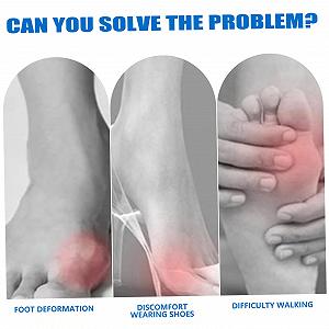 Коректор великого пальця стопи Регульований для жінок і чоловіків для лівої та правої ноги ціна на synthetic.ua - Фото 1 Коректор великого пальця стопи Регульований для жінок і чоловіків для лівої та правої ноги synthetic.ua - Фото 1