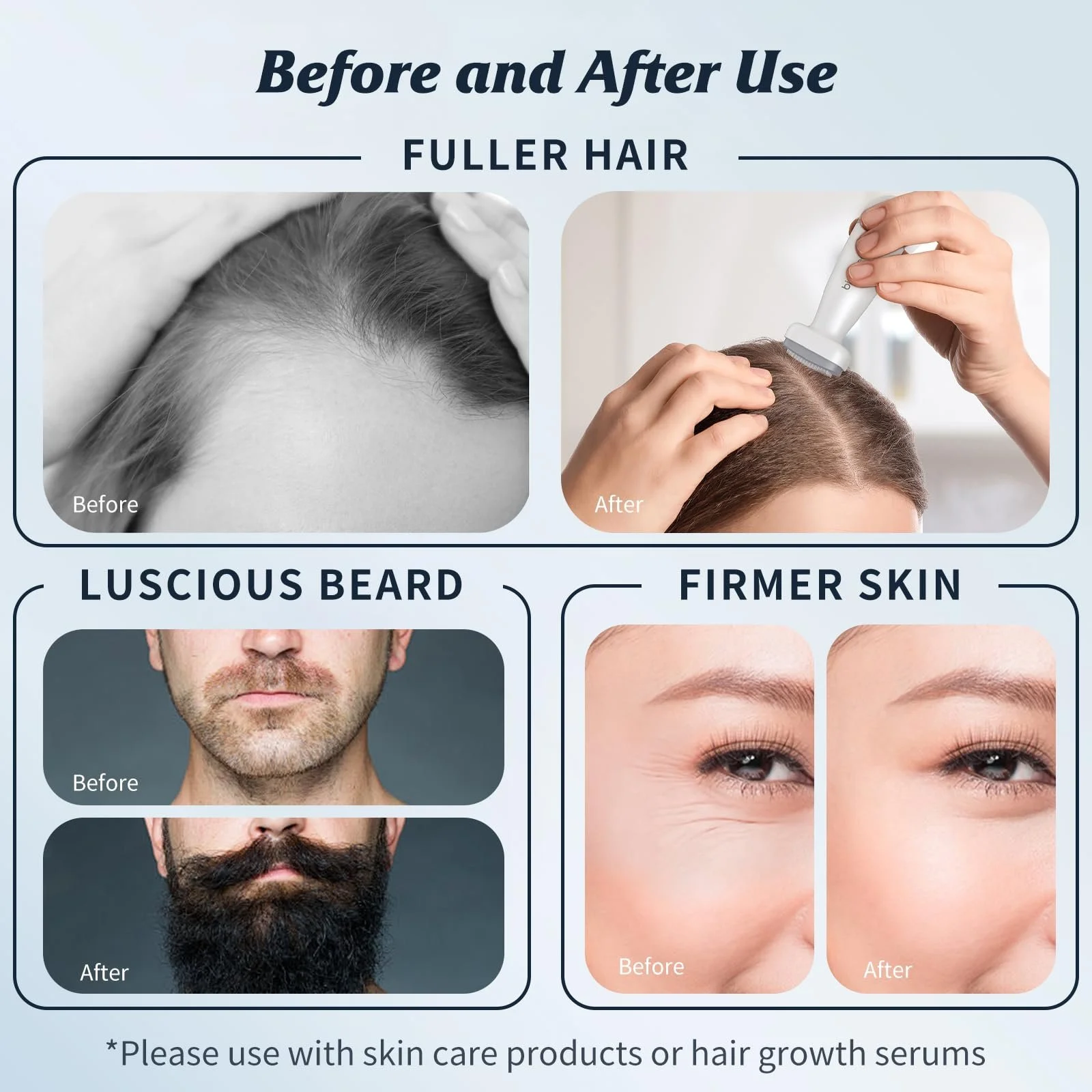 Дерма-штамп BIO120 для мікронідлінгу, регульований 0-2.0 мм, професійний, фото №5