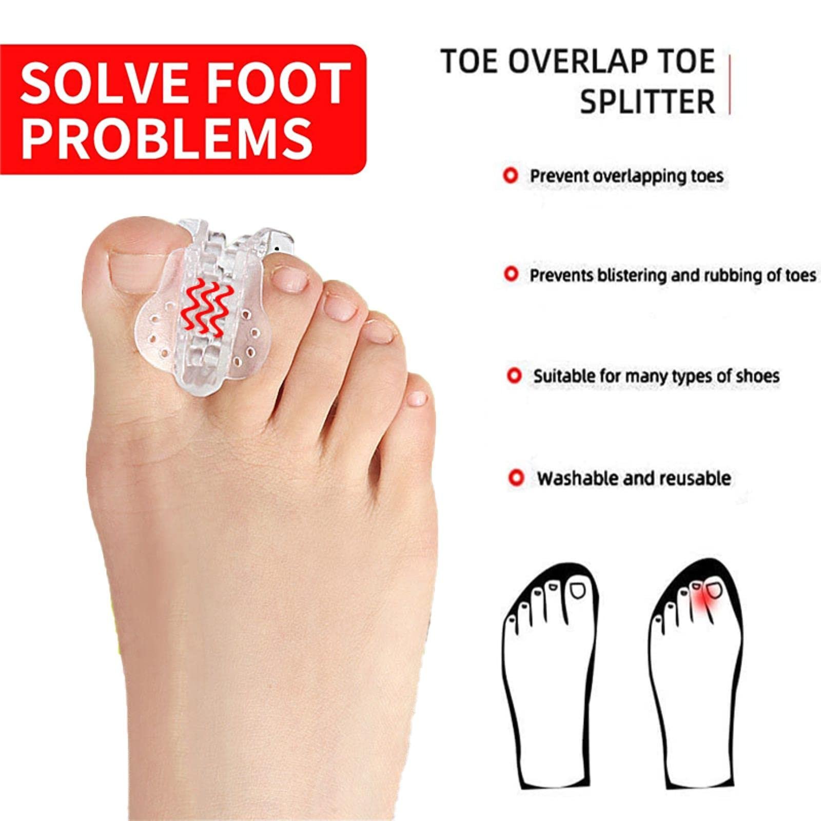 Роздільники для пальців гелеві 2/4 шт. для корекції вальгусної деформації та відновлення оригінальної форми, фото №3 Роздільники для пальців гелеві 2/4 шт. для корекції вальгусної деформації та відновлення оригінальної форми, фото №3