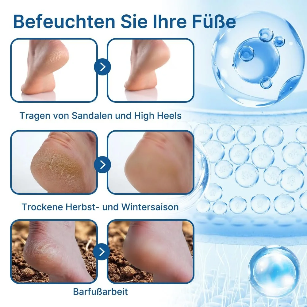 Набор кремов для ног Holoras 60% Urea Salicylic Acid 3 шт с 2 терками, фото №2 Набор кремов для ног Holoras 60% Urea Salicylic Acid 3 шт с 2 терками, фото №2