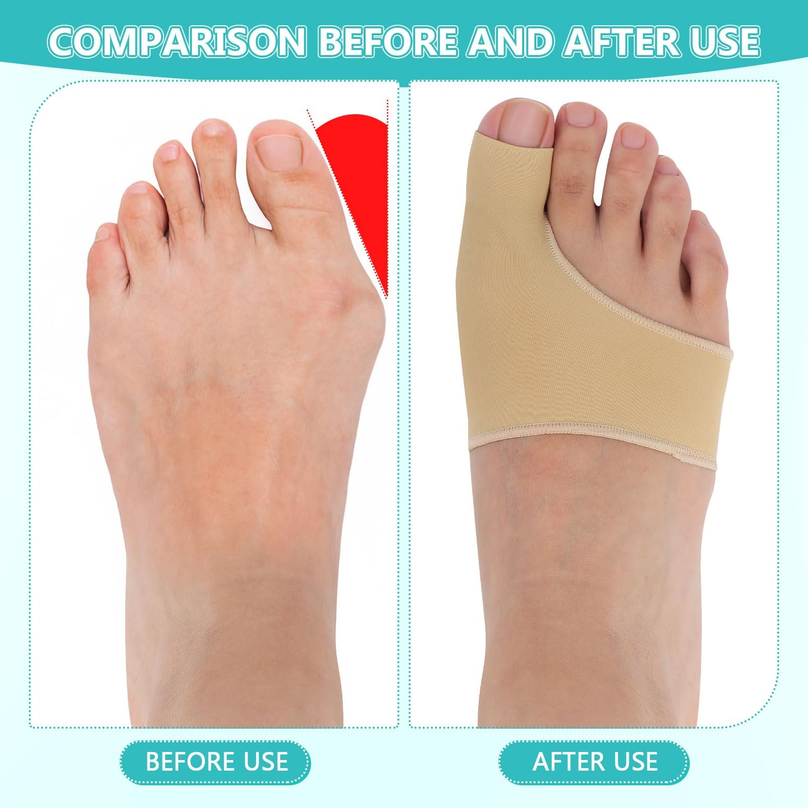 Шина Hallux Valgus Rosenice з роздільником для пальців і гелевою подушечкою, 2 шт., фото №5