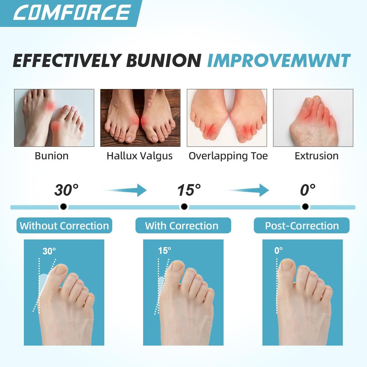 Коректор великого пальця стопи Hallux Valgus, 2 шт., Ультратонкий випрямляч, фото №2