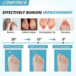 Коректор великого пальця стопи Hallux Valgus, 2 шт., Ультратонкий випрямляч synthetic.ua - Фото 1