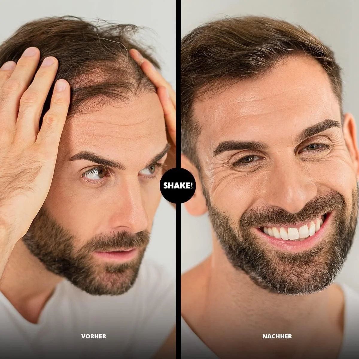 Набір для загущення волосся Vegan SHAKE OVER з волокнами, збагаченими цинком, фото №7