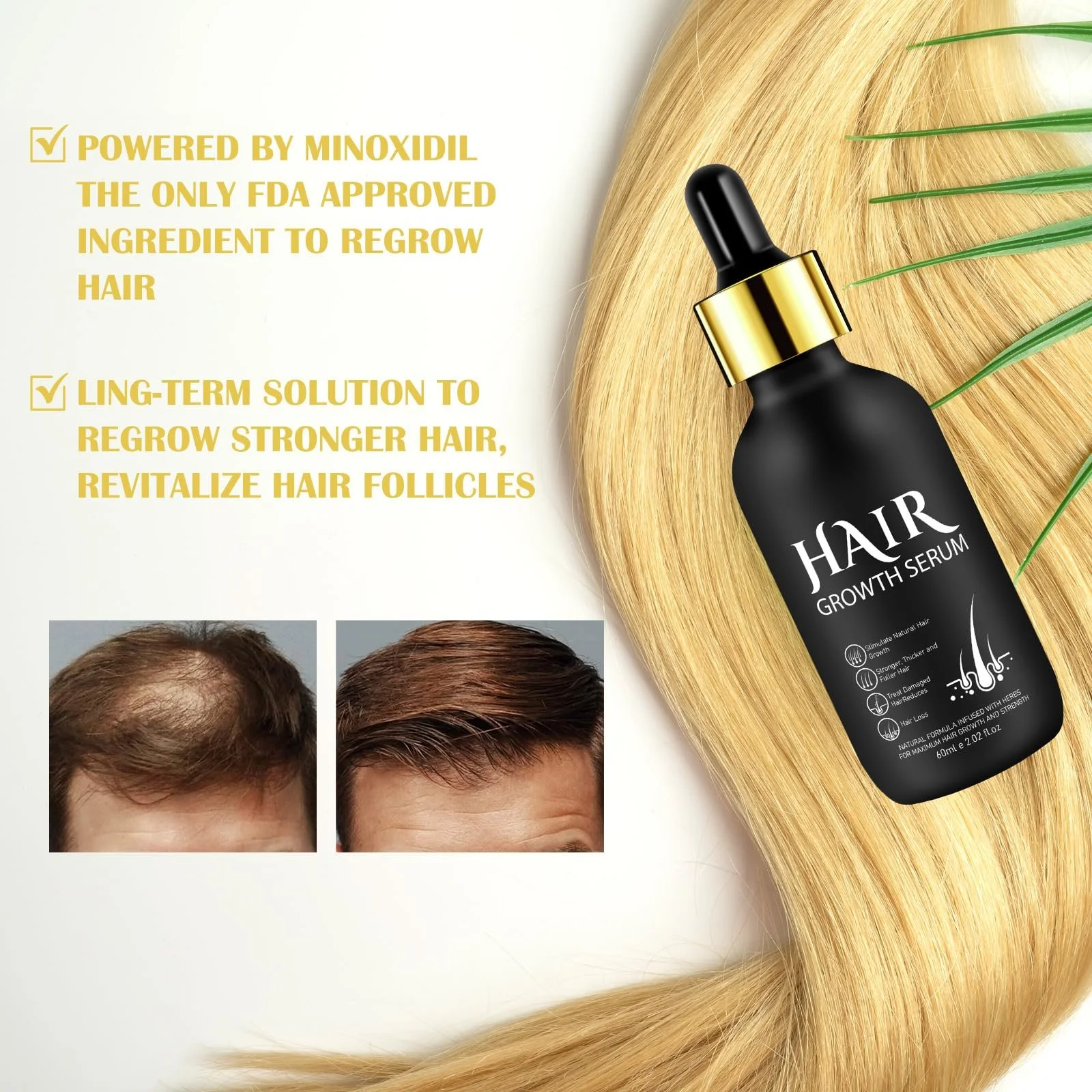 Органічна олія для росту волосся 5% - Розчин для зовнішнього застосування - Для росту та потовщення волосся, фото №10 Органічна олія для росту волосся 5% - Розчин для зовнішнього застосування - Для росту та потовщення волосся, фото №10