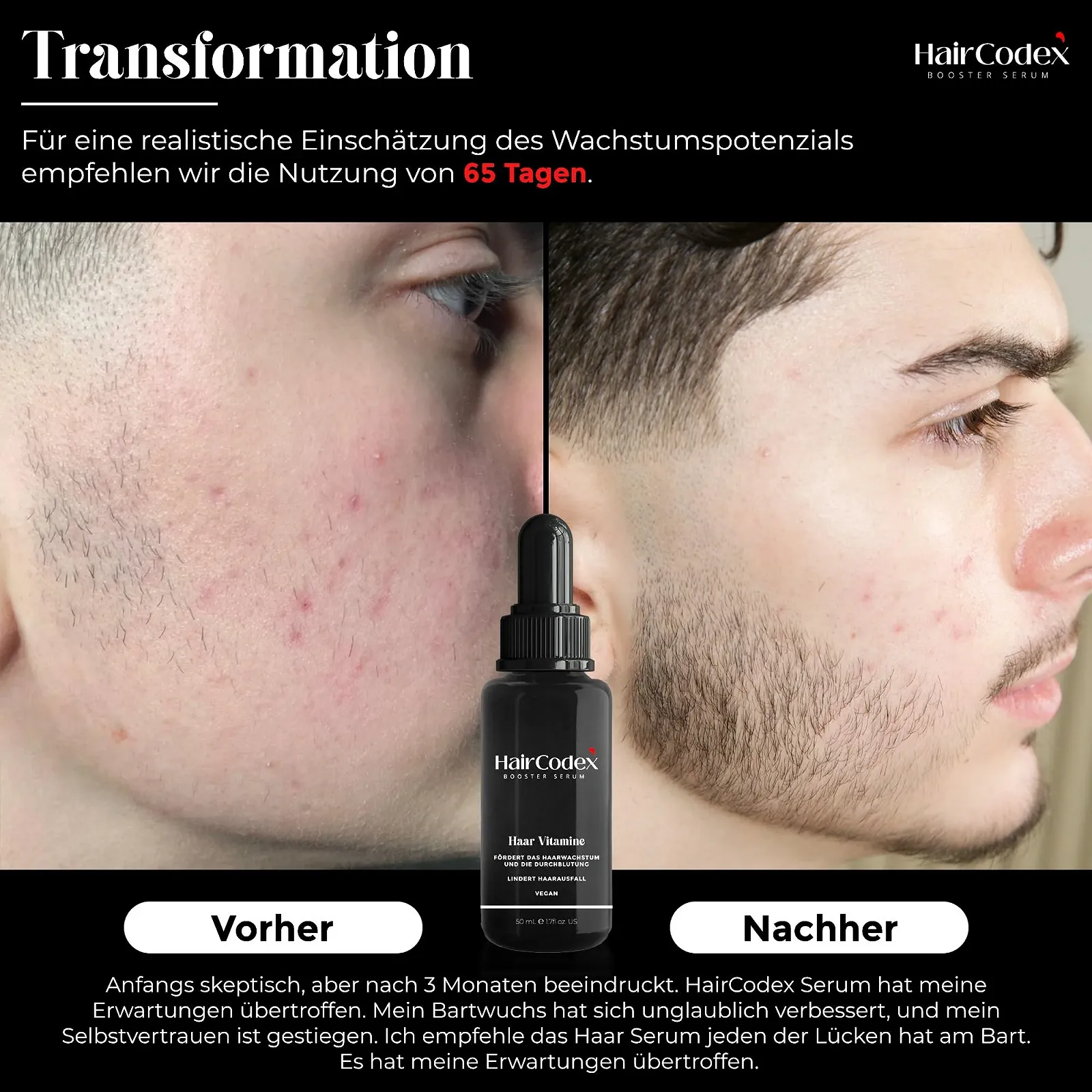 Сироватка-бустер HairCodex 50 мл, Агент для росту волосся, фото №5