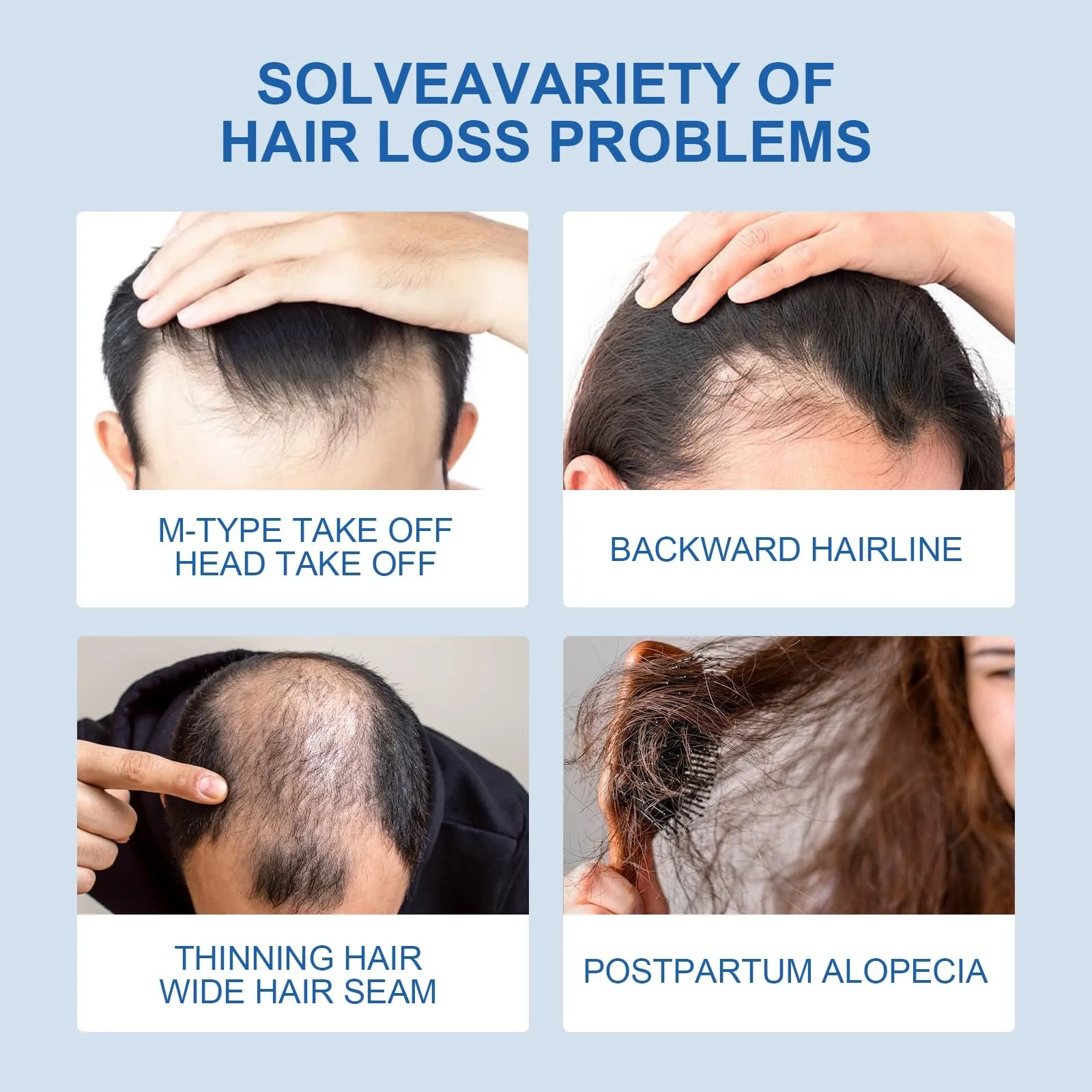 Засіб для росту волосся Натуральний 60 мл для чоловіків і жінок, фото №5