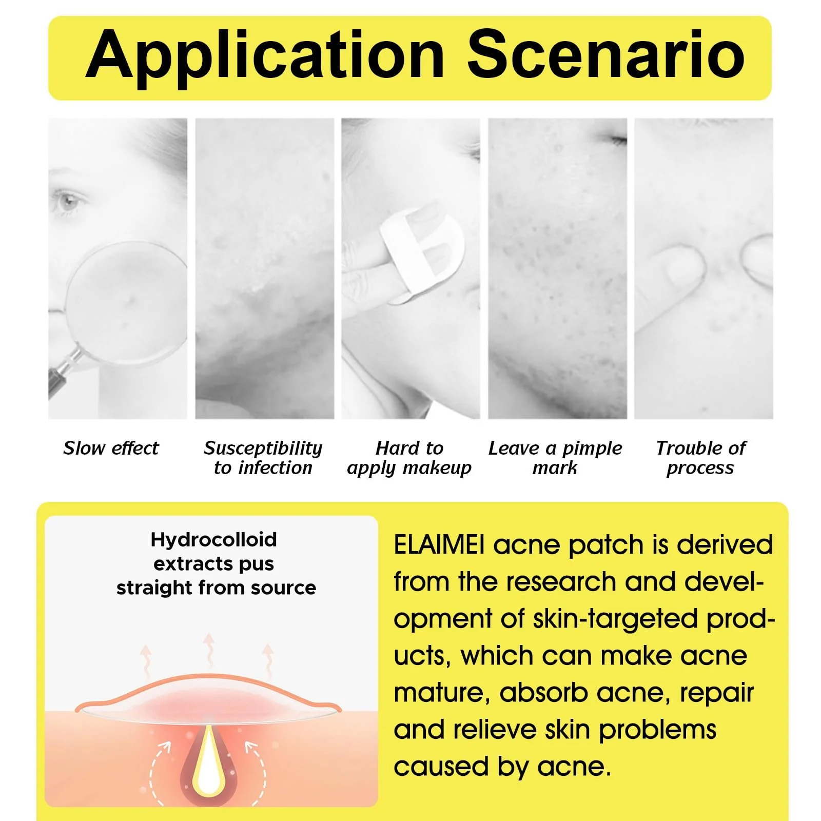 Патчі від прищів Tkekruh, 10 шт., патчі від прищів, потовщені, фото №6