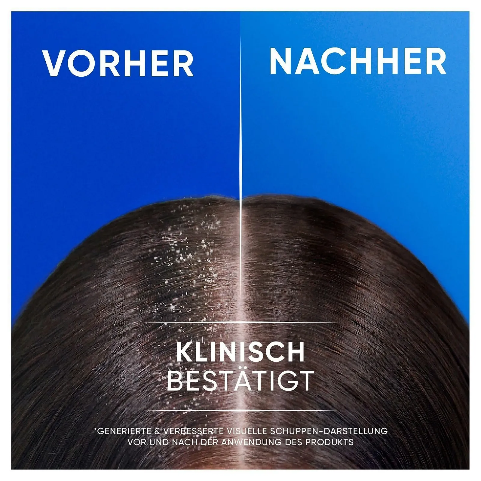 Шампунь против перхоти 2-в-1 Head & Shoulders Citrus Fresh для жирных волос, 800 мл, до 100% защиты от перхоти, свежий цитрусовый аромат, фото №6 Шампунь против перхоти 2-в-1 Head & Shoulders Citrus Fresh для жирных волос, 800 мл, до 100% защиты от перхоти, свежий цитрусовый аромат, фото №6