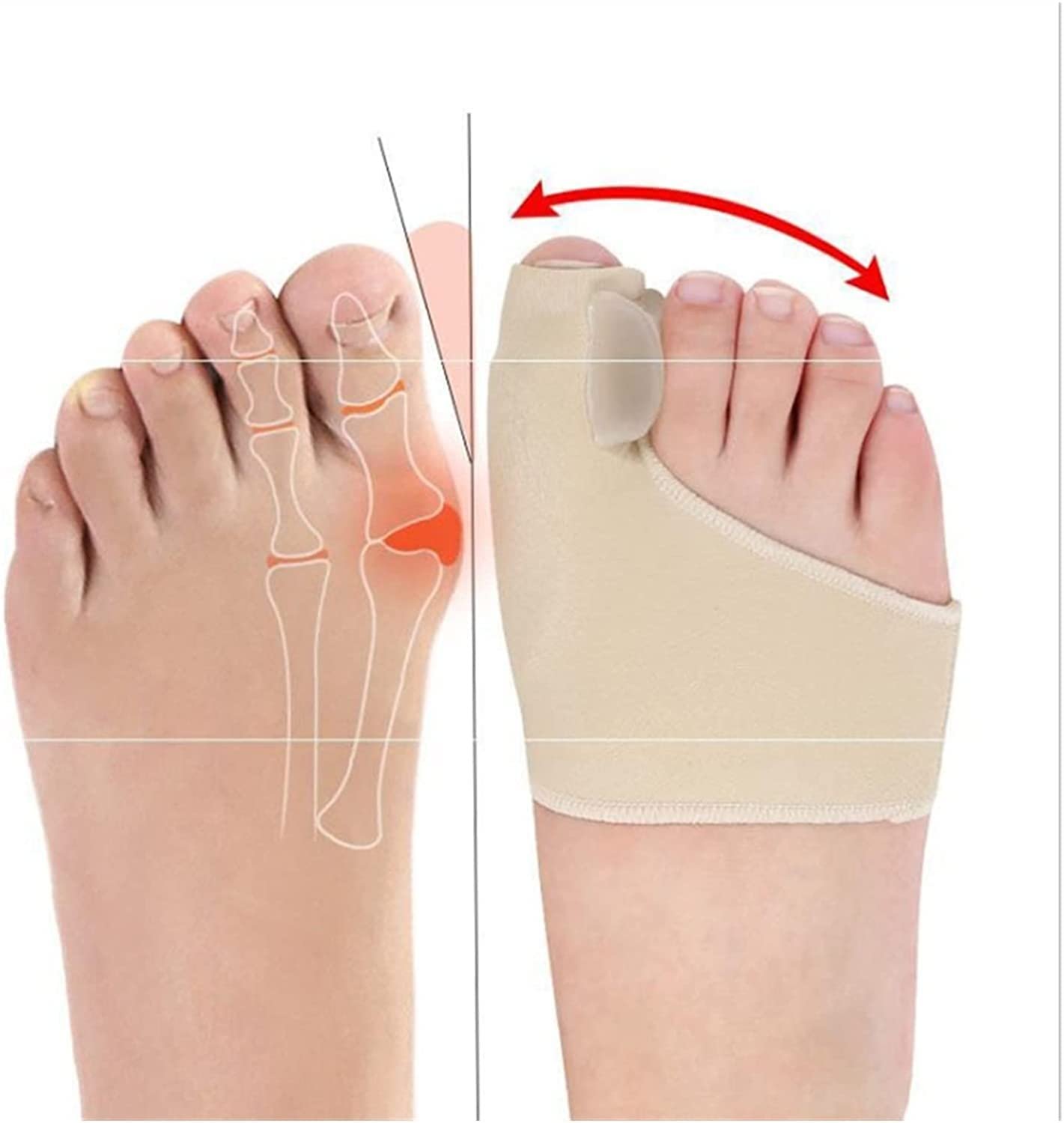 Роздільник для пальців ніг Hallux Valgus, коректор кісточки великого пальця, фото №1 Роздільник для пальців ніг Hallux Valgus, коректор кісточки великого пальця, фото №1