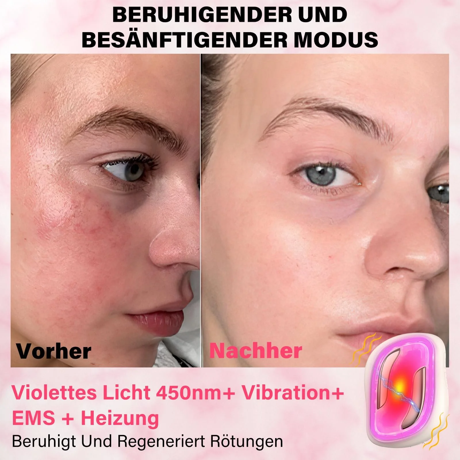 Прибор для массажа лица против морщин EMS с массажными камнями из жадеита, вибрацией и нагревом, RF beauty device, устройство для подтяжки лица со светодиодной красной подсветкой, фото №5