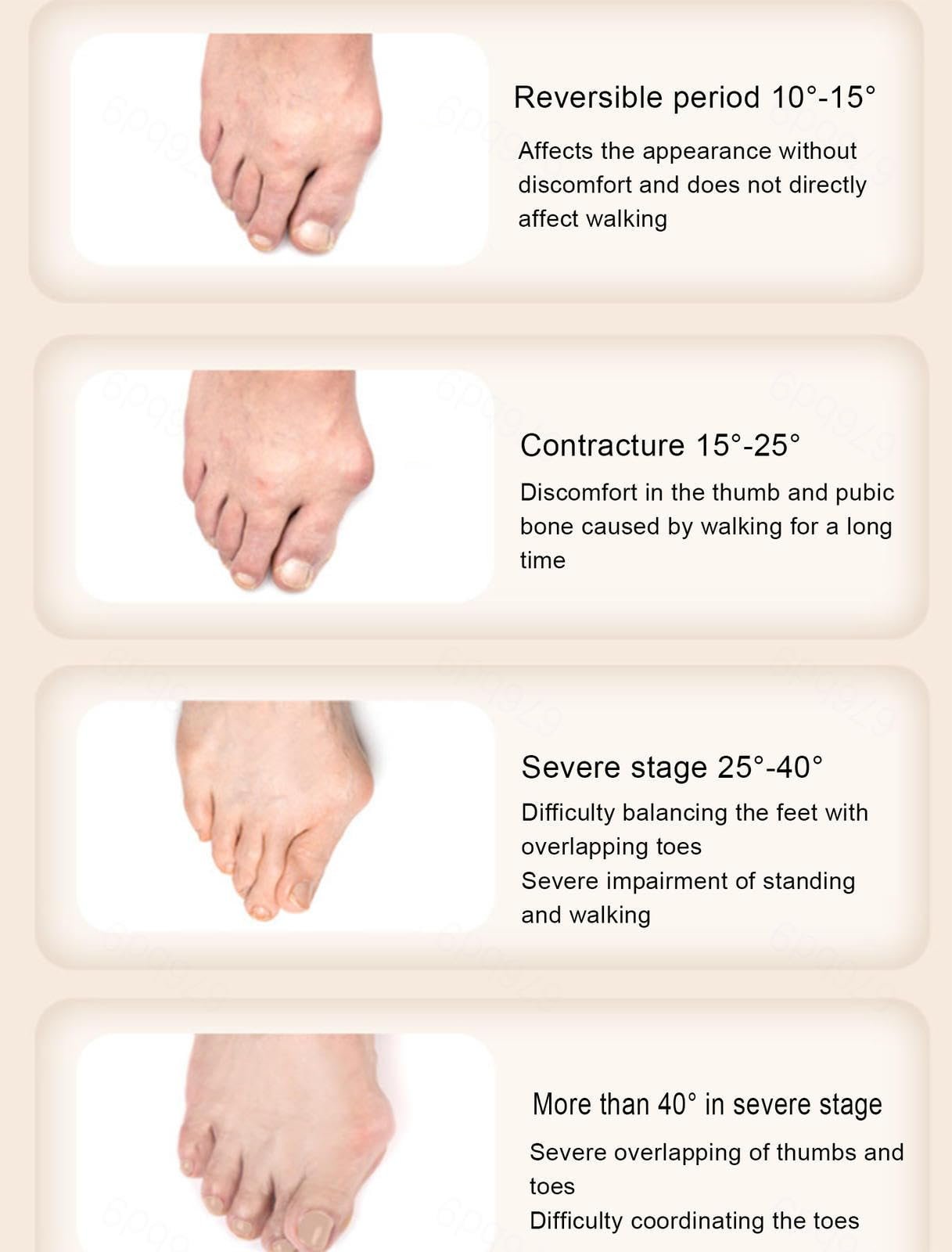 Коректор Videcor Hallux-Valgus-Bunion для жінок та чоловіків, ортопедична шина для полегшення болю, фото №7