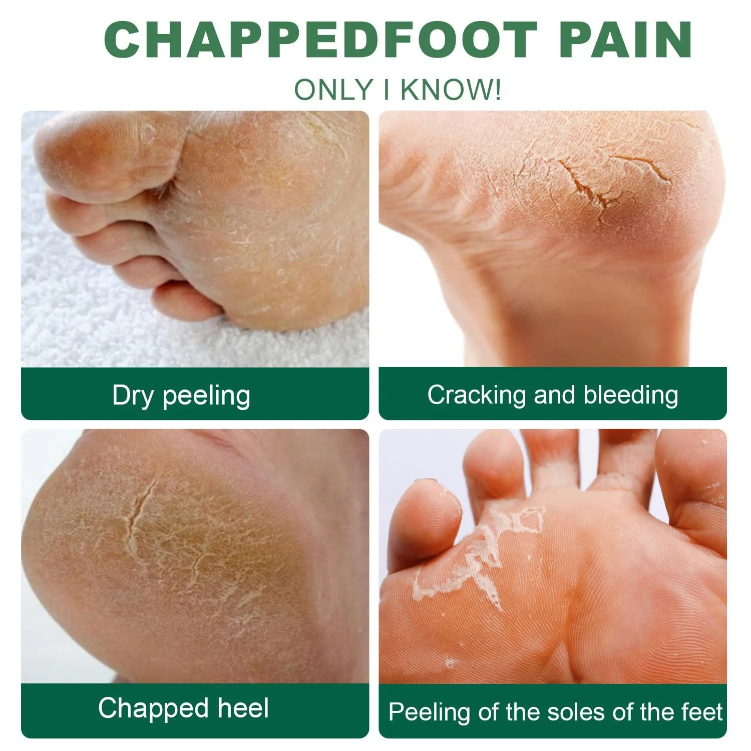 Крем для ног увлажняющий с чайным деревом против трещин и мозолей 100 г, фото №5