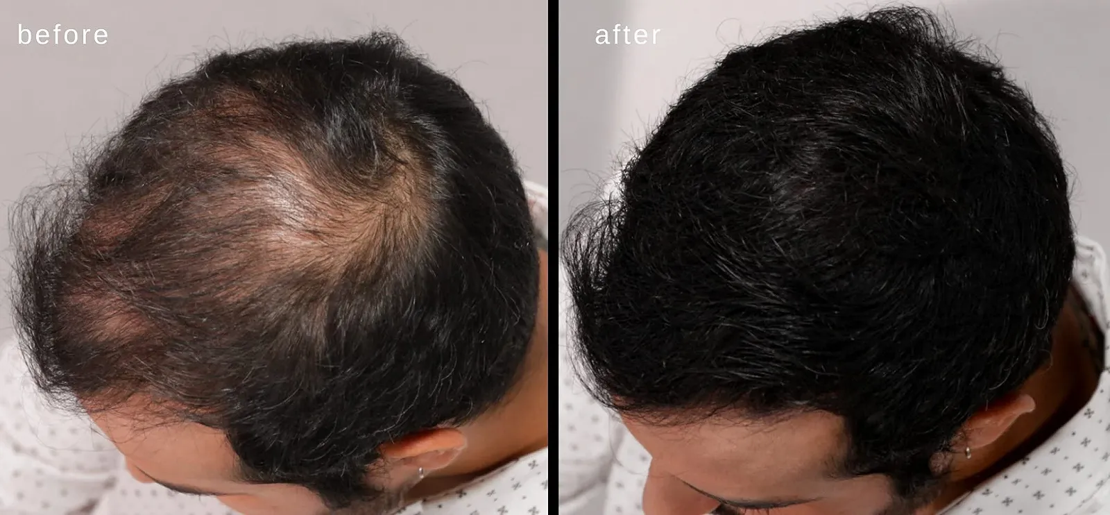 Волокна для загущення волосся LUXE з натуральним кератином Темно-коричневий, фото №6