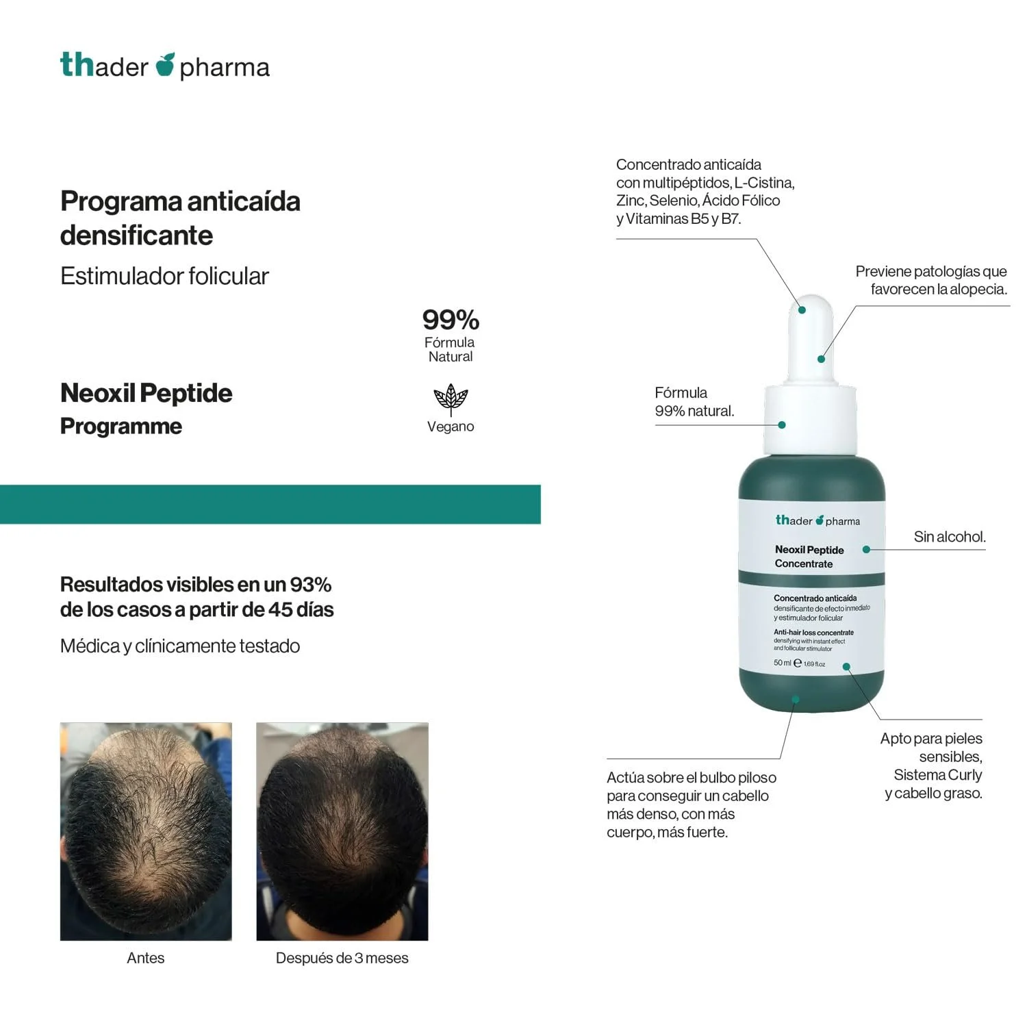 Лосьйон Thader Pharma Концентрований проти випадіння волосся з мультипептидами Neoxil Peptides 50 мл, фото №5 Лосьйон Thader Pharma Концентрований проти випадіння волосся з мультипептидами Neoxil Peptides 50 мл, фото №5