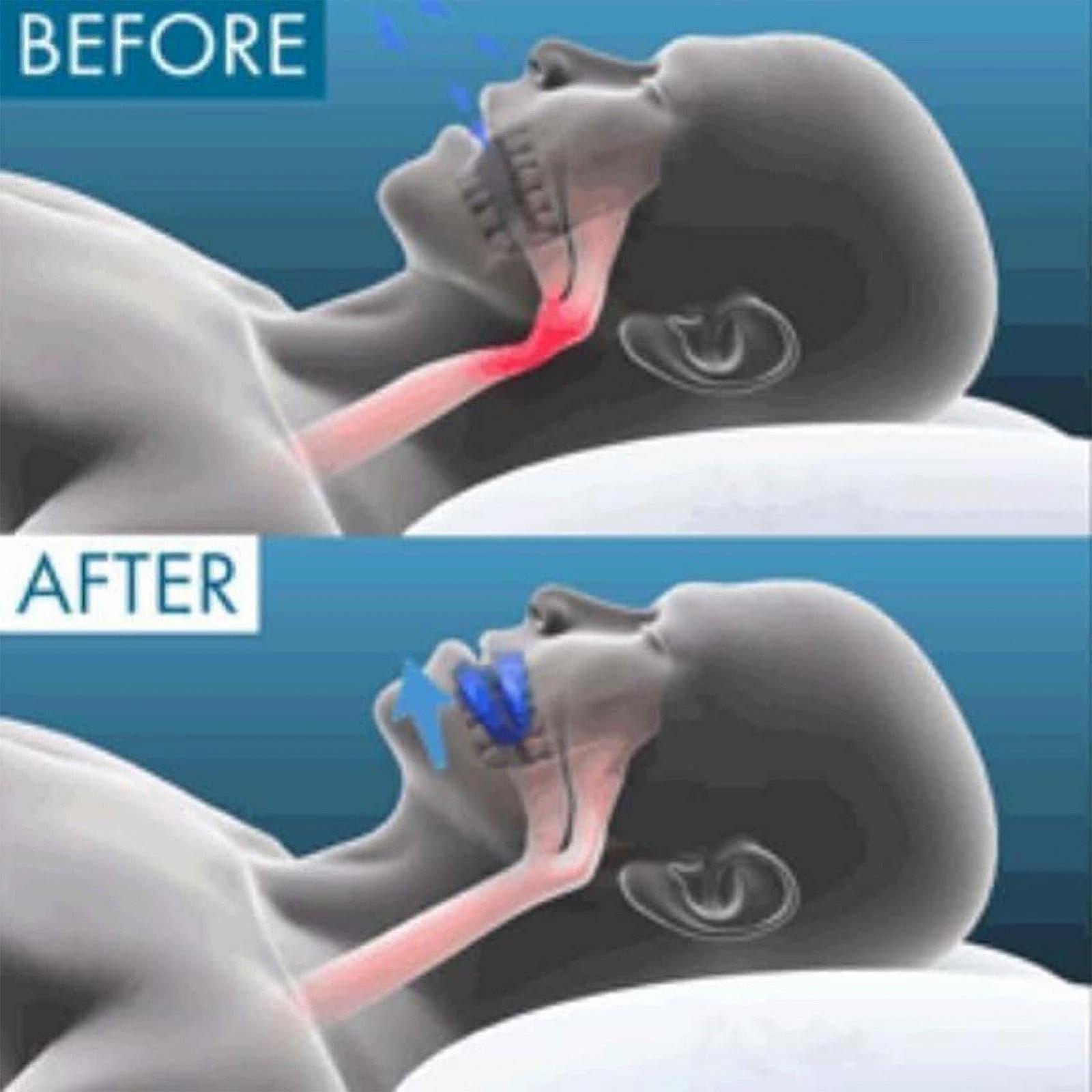 Капа від хропіння для чоловіків Набір, фото №5