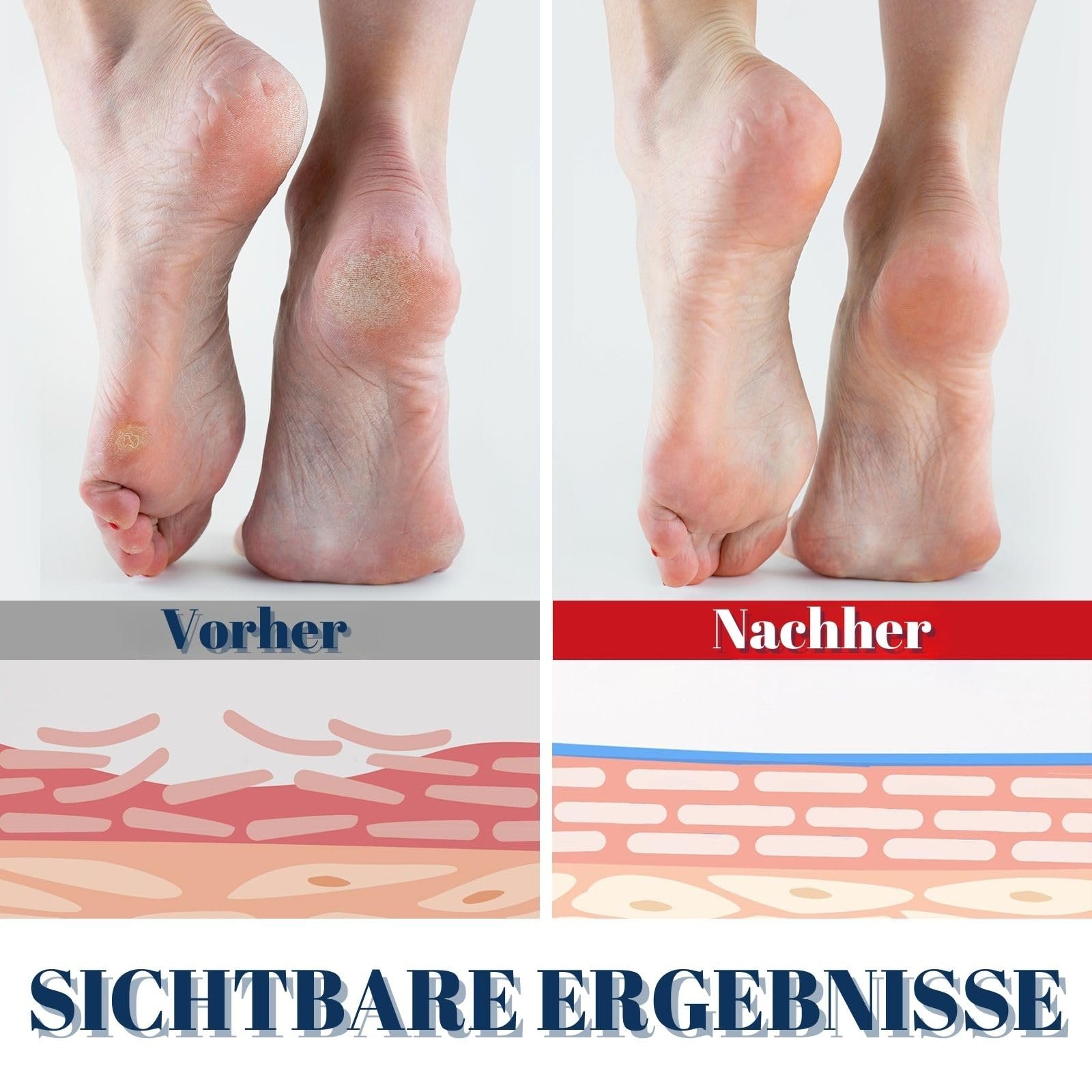 Бальзам-стік для ніг з сечовиною Urea Fußbalsam Stick 60% з саліциловою кислотою для сухої шкіри 2 шт. по 40 г, фото №4