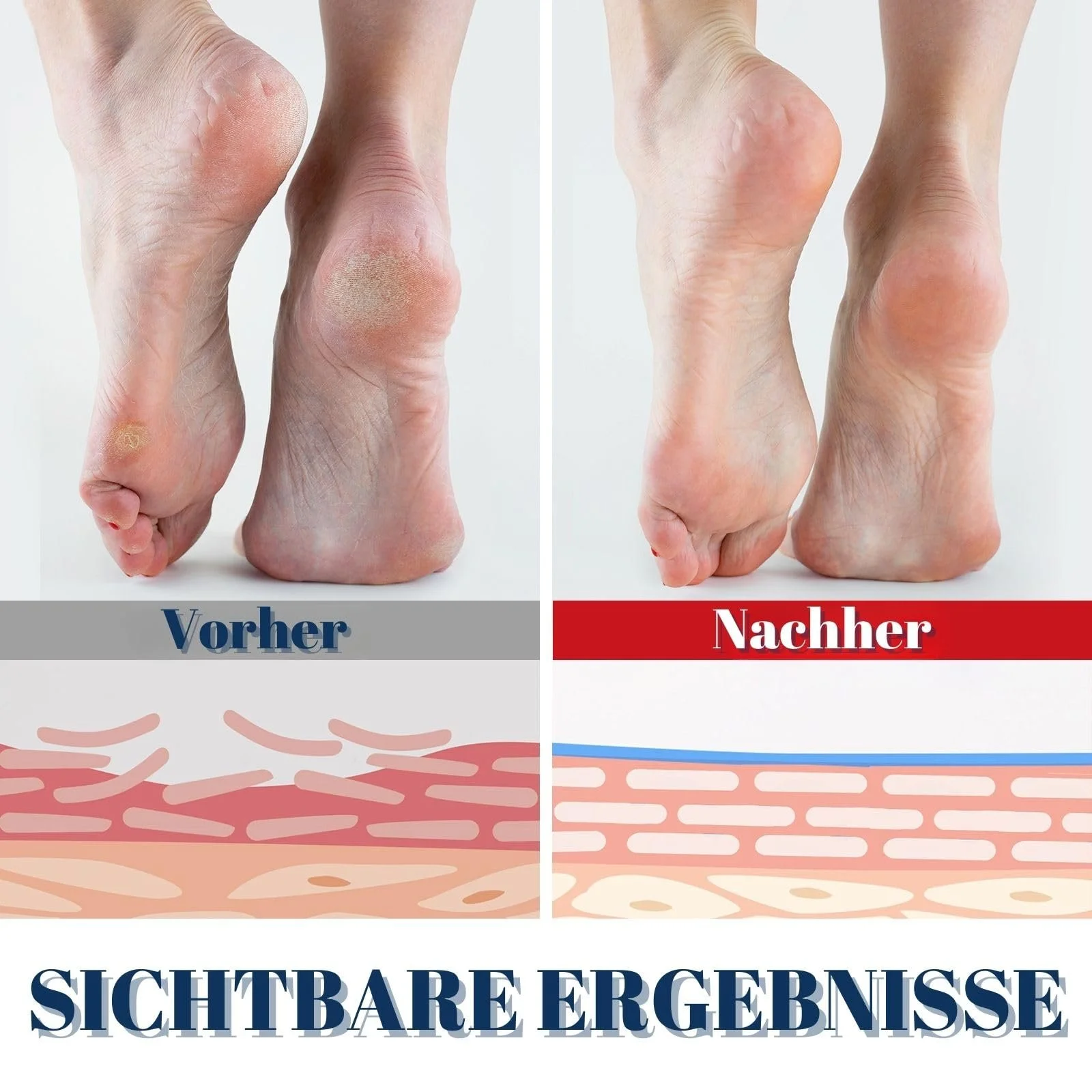 Крем-бальзам для ног в стике Urea 60% и 2% салициловой кислоты 40 г 1 шт., фото №4
