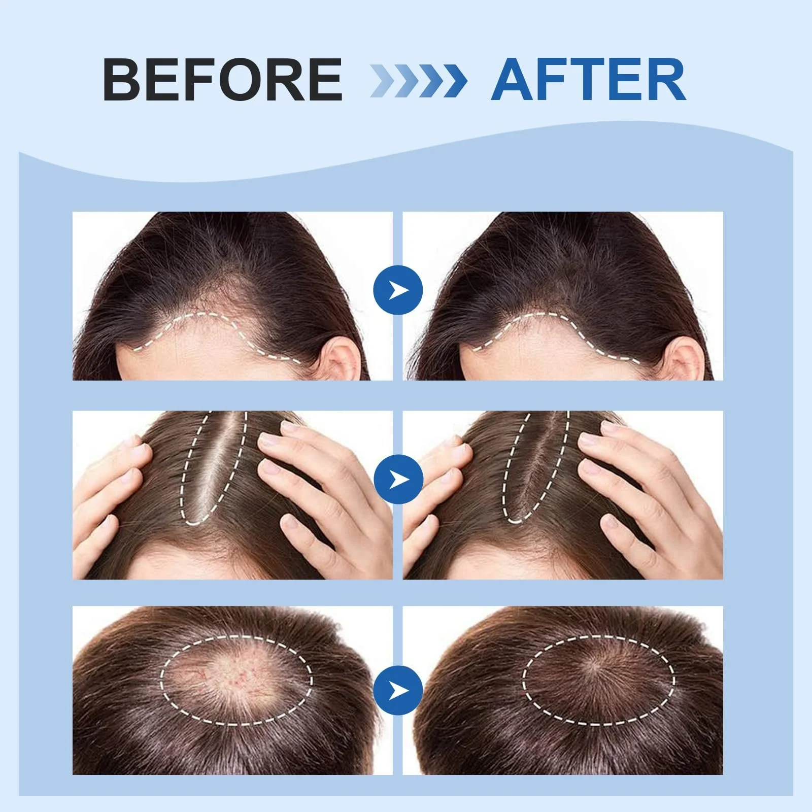 Сироватка для росту волосся 60 мл, Засіб для росту волосся для жінок та чоловіків, фото №6