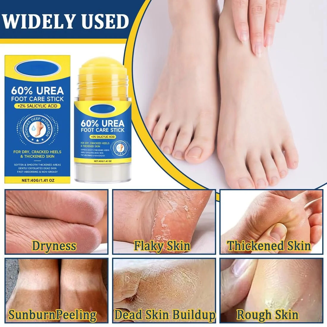 Стик-крем для ног с мочевиной 60% для потрескавшихся пяток и сухой кожи 30 г, фото №5